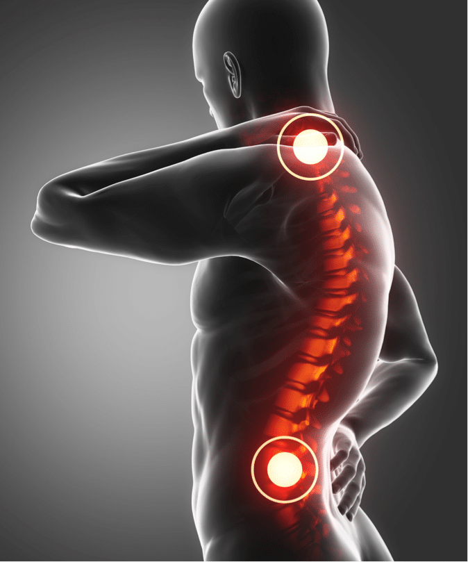 Spinal_Stenosis_West_Texas_Neck_Back